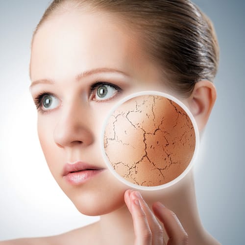 Экзема на лице: симптомы заболевания и его лечение